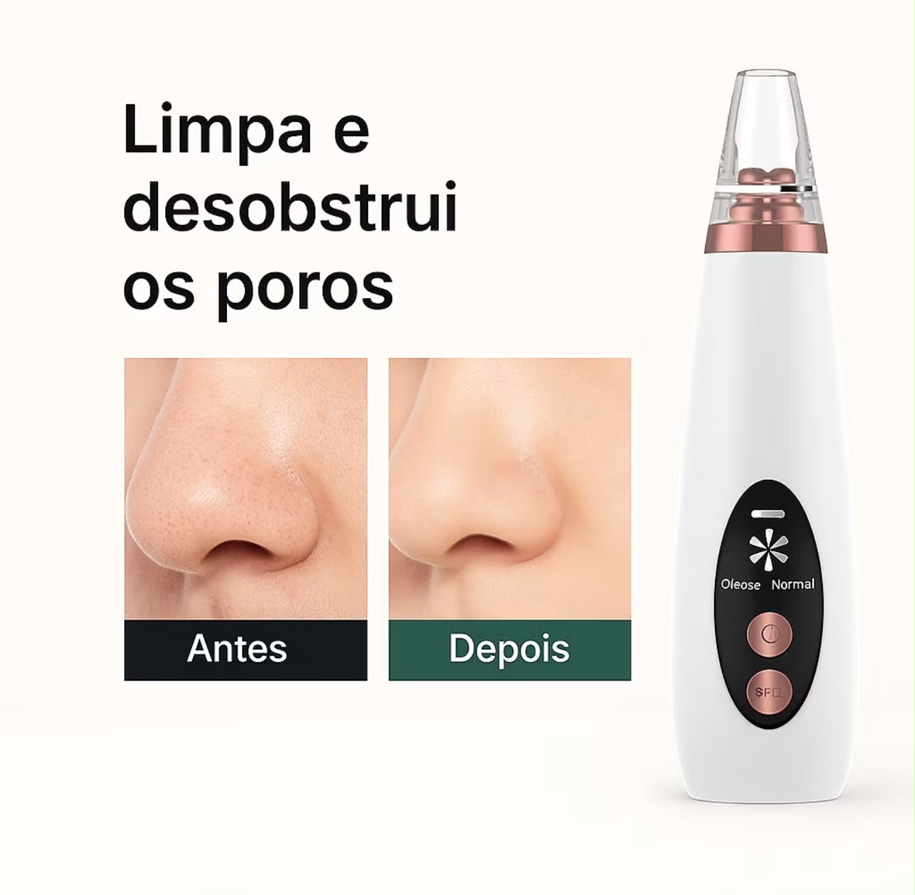 Removedor De Cravos E Espinhas Cleaning USB Recarregável Portátil