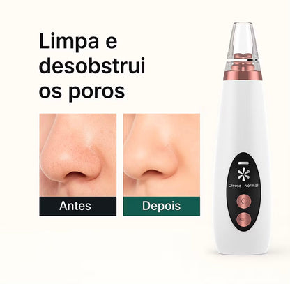 Removedor De Cravos E Espinhas Cleaning USB Recarregável Portátil