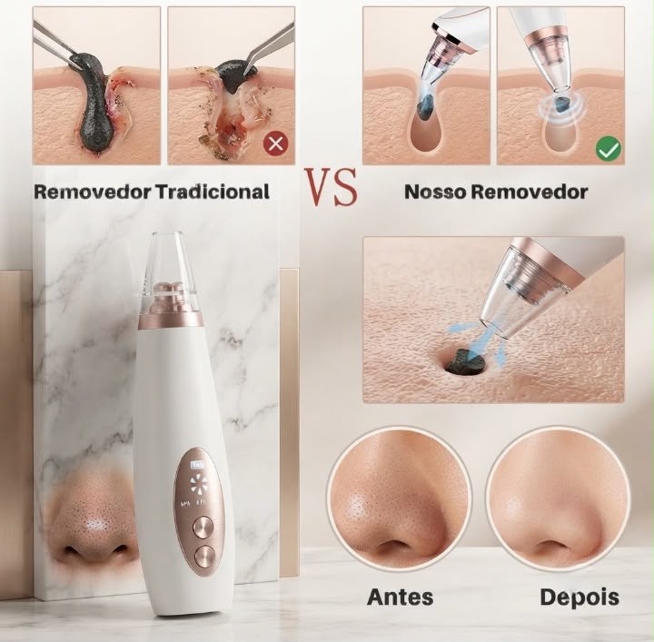 Removedor De Cravos E Espinhas Cleaning USB Recarregável Portátil