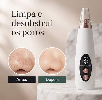 Removedor De Cravos E Espinhas Cleaning USB Recarregável Portátil